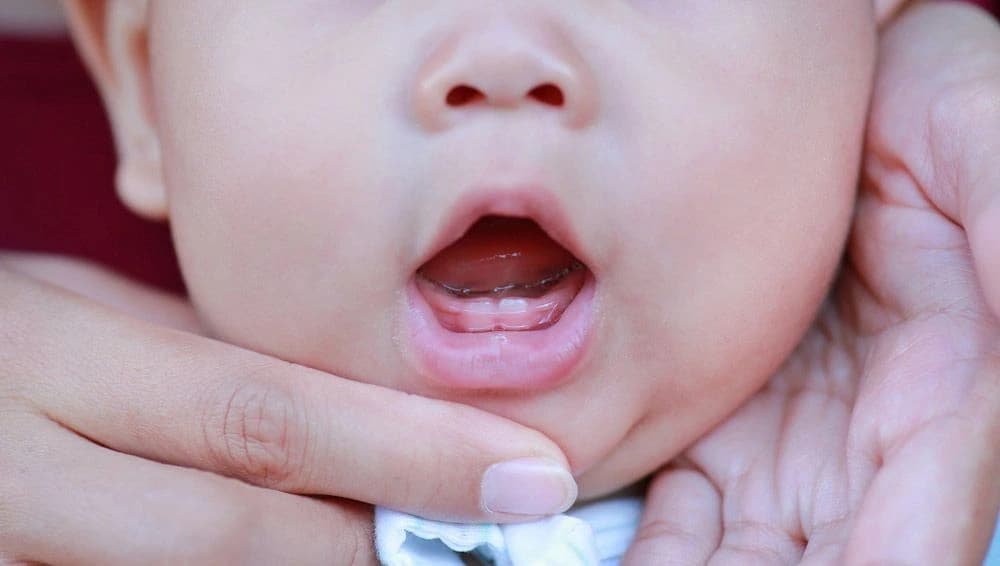 When Do Baby Teeth Start Coming In? Teething Guide for Parents