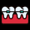 Clear Ceramic Braces