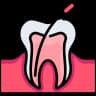 Root Canal Treatment